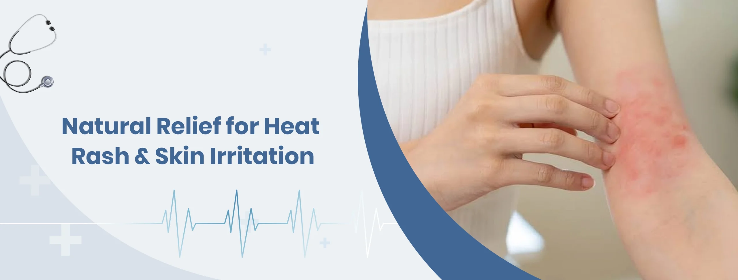 Homepage 133 Natural Relief for Heat Rash Skin Irritation scaled