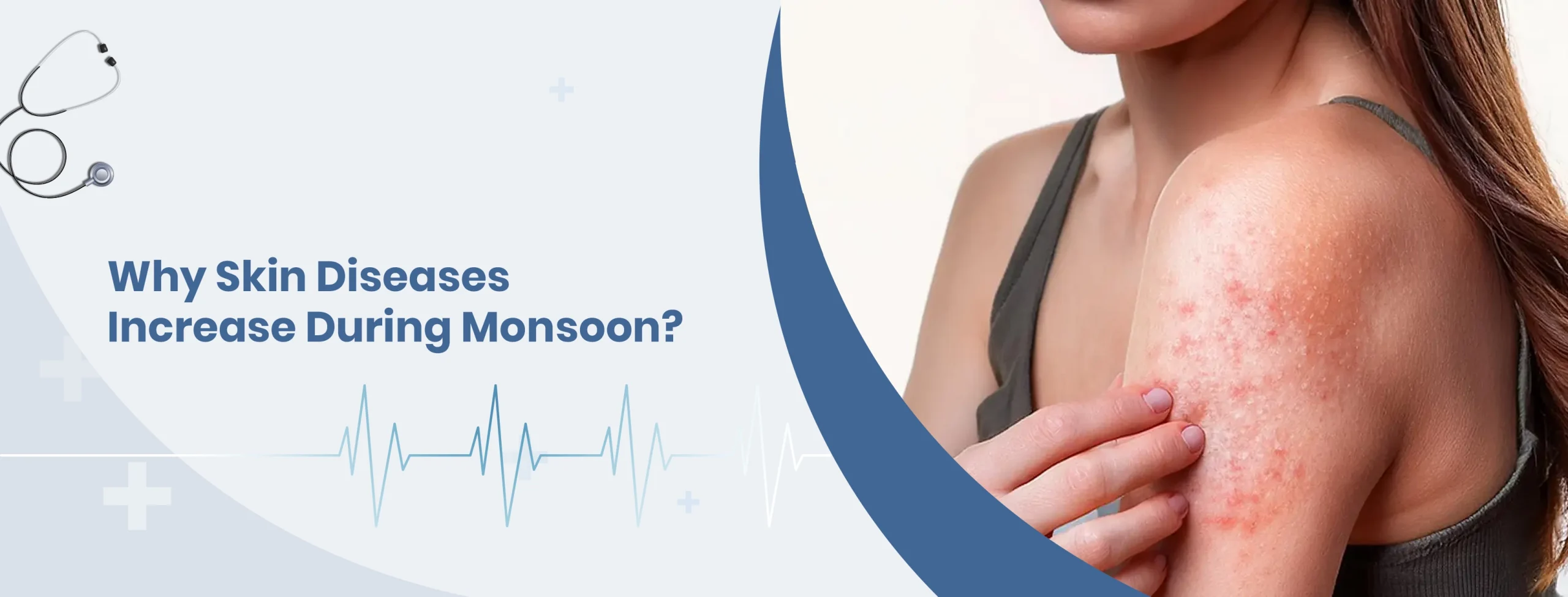 Homepage 131 Why Skin Diseases Increase During Monsoon scaled